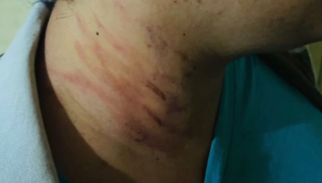 violência doméstica