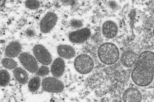 Goiânia confirma 29º caso de varíola dos macacos e transmissão comunitária