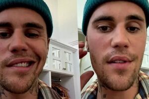 Justin Bieber apresenta melhora após paralisia facial e fala de apoio espiritual: "Jesus está comigo"