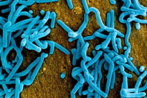 Tanzânia confirma surto do vírus Marburg, de grande letalidade Pelo menos oito casos foram confirmados na Tanzânia