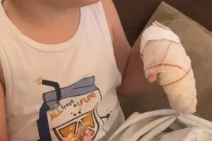 Criança tem ponta do dedo amputada após ter mão prensada em armário pela professora em Goiânia