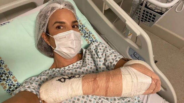 Ivete Sangalo tranquiliza fãs após cirurgia no braço: 'Mainha está zero bala'
