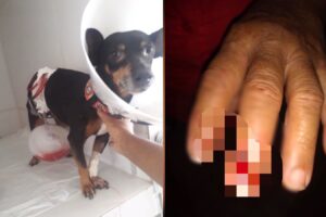 Idosa e cachorra ficam feridas após ataque de pitbull em Goiânia