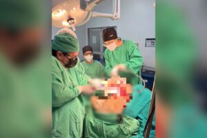 Morre mulher que teve tumor de 46kg retirado em cirurgia de emergência no Rio