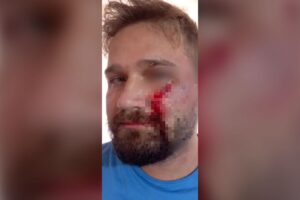 Médico é agredido com golpes de capacete após negar atestado a jovem em Aragoiânia