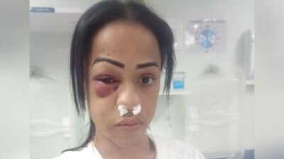 Polícia prende homem acusado de atirar contra mulher trans na Região Metropolitana do Rio1