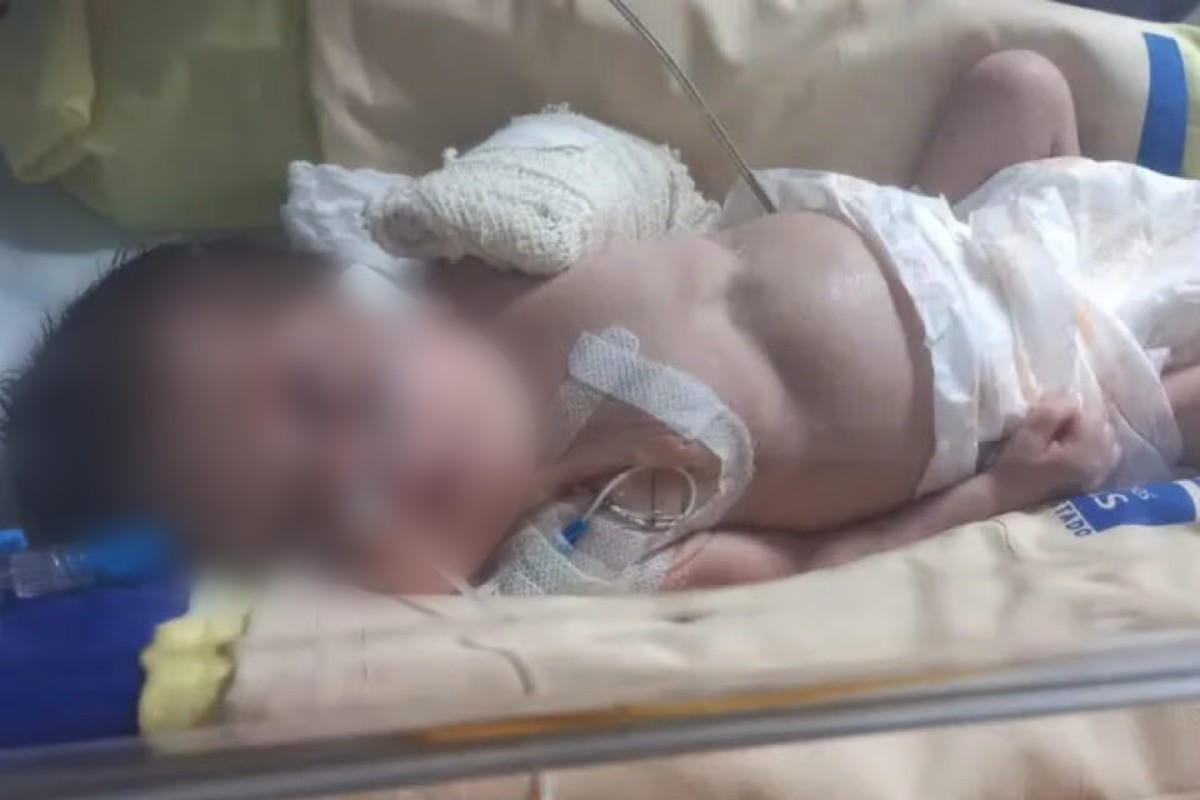 Pais acusam Materno-Infantil de querer dar alta a bebê com fratura, mas hospital nega (Foto: Reprodução - Arquivo Pessoal)