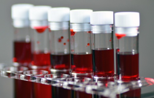 Cientistas descobrem novo grupo sanguíneo que era um mistério há quatro décadas