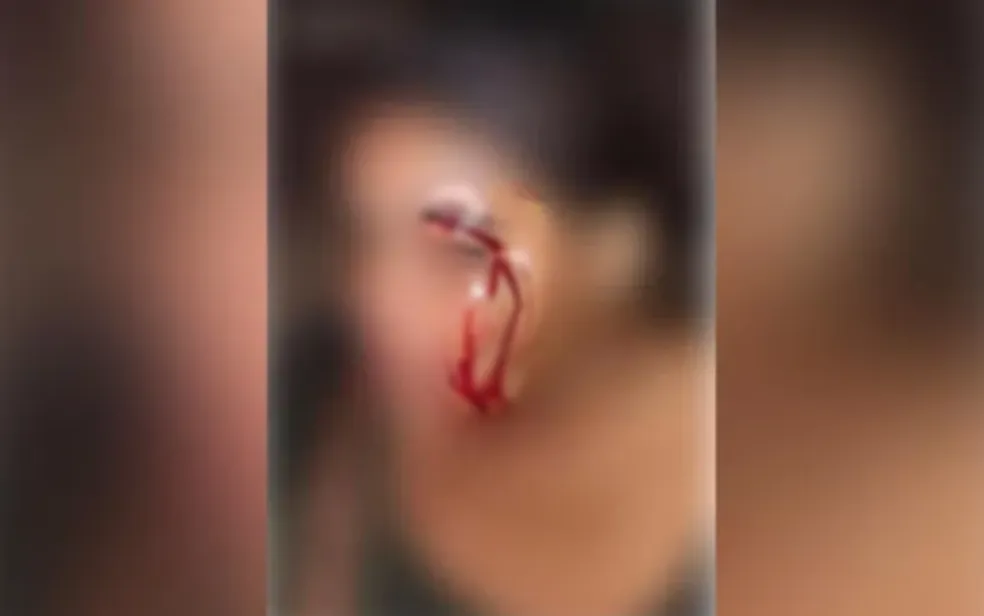 Suspeito de agredir mulher com capacete na frente dos filhos é preso em Minaçu (GO)