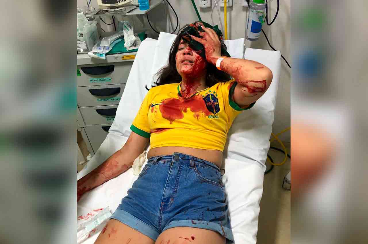 Petista atira pedra contra carreata de Bolsonaro e atinge criança de 13 anos