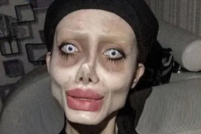 Fatemeh Khishvand deixou prisão após três anos Jovem conhecida como Angelina Jolie Zumbi mostra seu verdadeiro rosto; veja