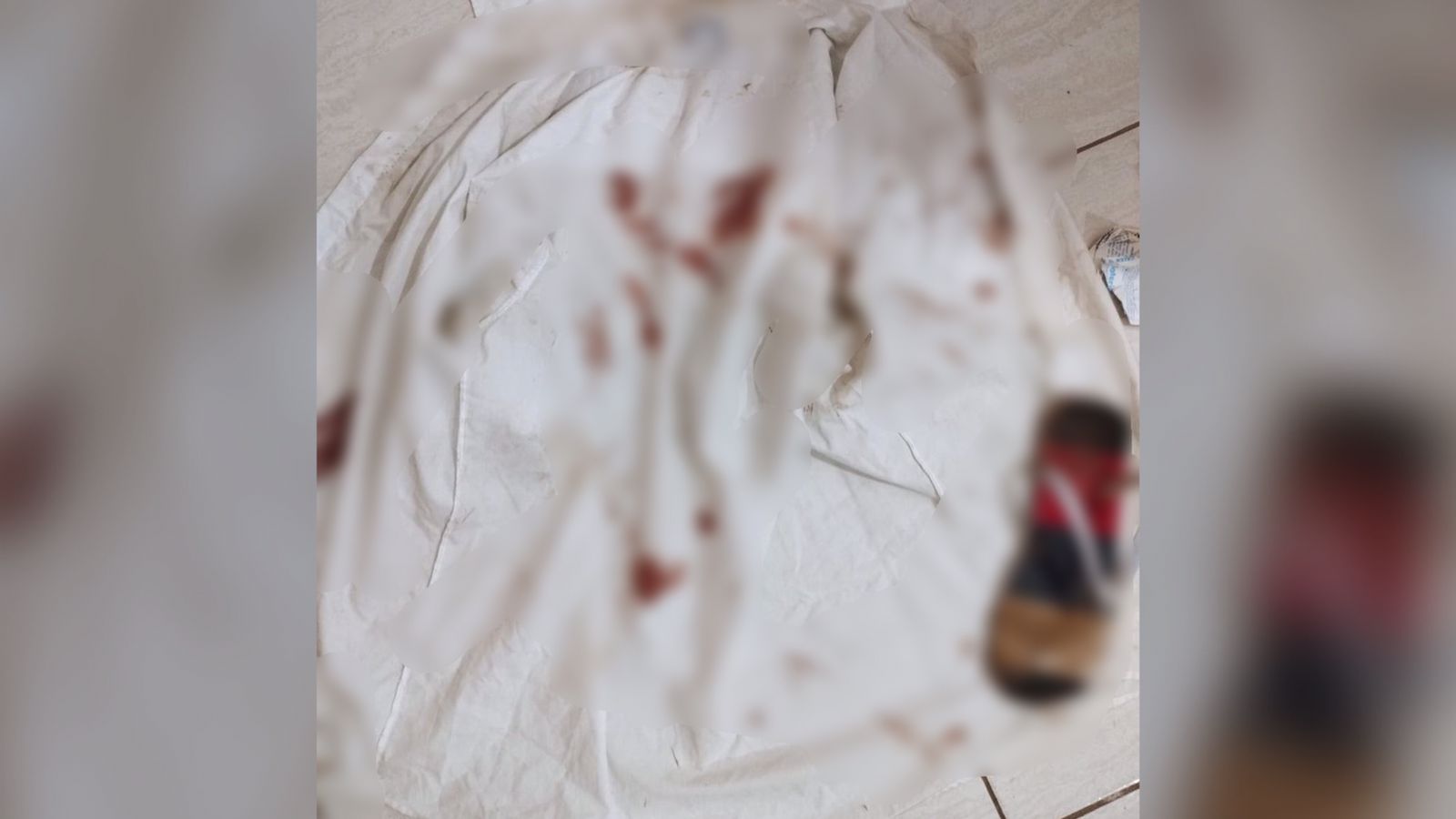 Vítima foi agredida com socos e pedradas na cabeça (Foto: Divulgação - Polícia Civil)