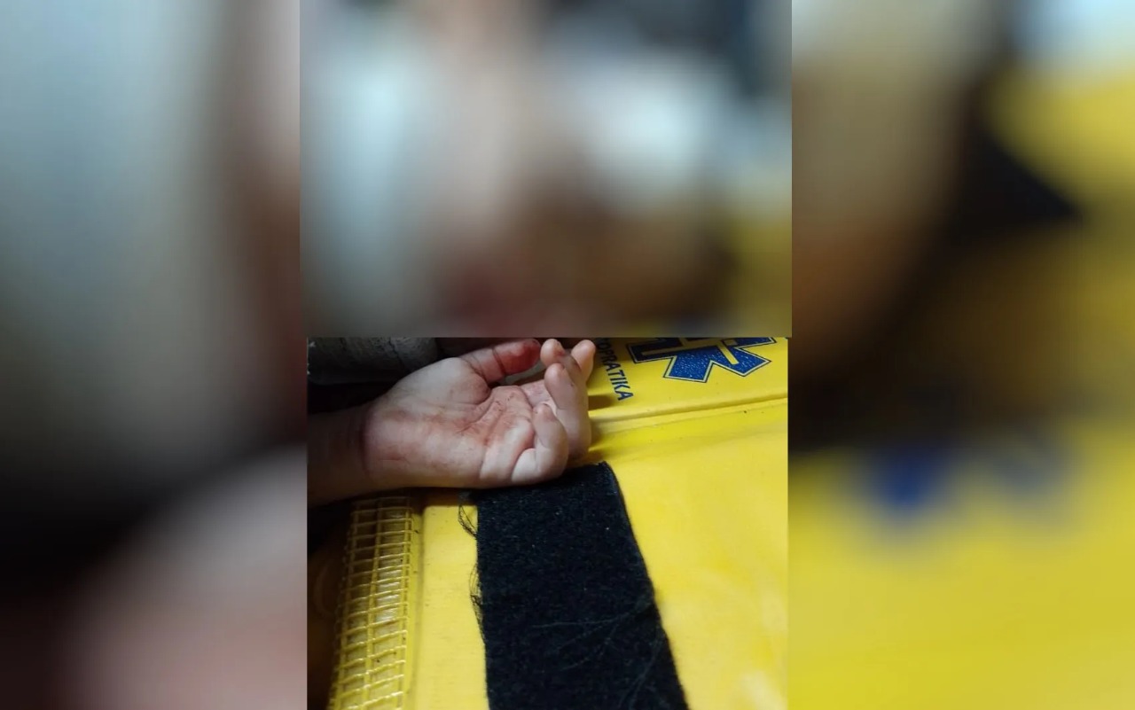Apesar do susto, a criança atropelada sofreu apenas ferimentos leves. (Foto: reprodução/redes sociais)