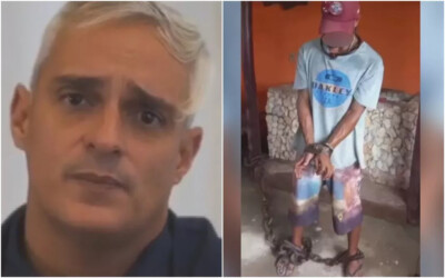 Médico acusado de racismo acorrentou funcionário simulando que a vítima era escrava. (Foto: reprodução)