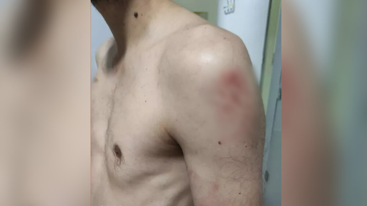 Dupla de servidores públicos e PM viram réus por roubar e agredir vereador de Iporá (Foto: Reprodução – Arquivo Pessoal)