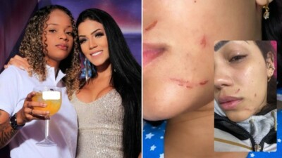 Larissa Novais mostrou ferimentos no rosto e hematomas nas pernas e braços Ex-mulher de Mc Dricka expõe agressões da funkeira após fazer B.O