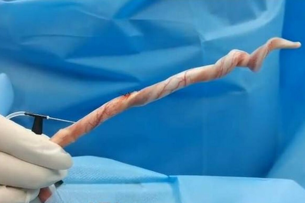 45f44c84-penis-bionico
