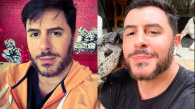 Ator afirma que não fez harmonização facial Ricardo Tozzi fala da mudança na aparência e de repercussão de foto com Reynaldo Gianecchini