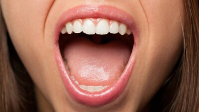 Uma língua saudável é rosada e tem pequenos nódulos chamados papilas Aparência da língua pode revelar problemas de saúde