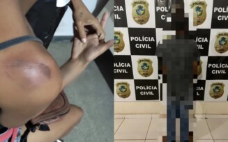 Pedreiro  preso suspeito de agredir a esposa com socos no rosto e mordidas, em Posse