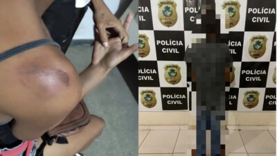 Pedreiro é preso suspeito de agredir a esposa com socos no rosto e mordidas, em Posse