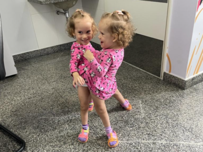 Gêmeas siamesas Valentina e Heloa Prado, de três anos (Foto: divulgação)
