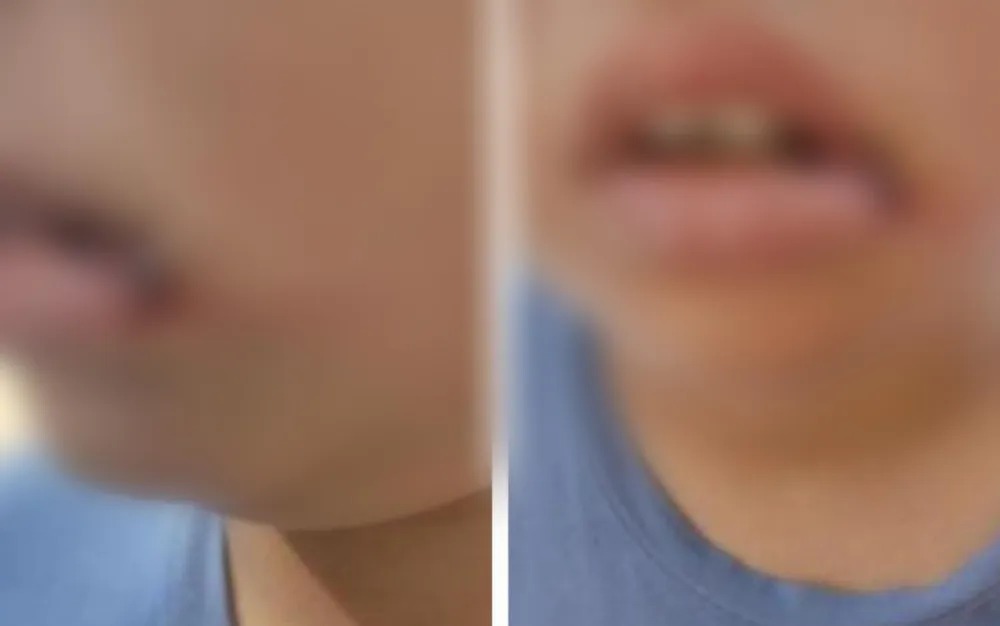 Homem é preso após arremessar filho da namorada no chão; menino teve dentes quebrados e precisou levar pontos Caso aconteceu em Goiânia