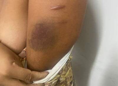 Um homem foi preso, no final da última semana, suspeito de agredir a esposa e a enteada, de 3 anos, em Aparecida de Goiânia.