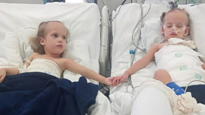 Heloá e Valentina, siamesas separadas em hospital de Goiânia, recebem alta da UTI