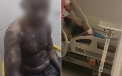 Universidade de Rio Verde publicou nota Mãe encontra o filho desacordado e coberto de tinta após trote em Rio Verde; jovem foi hospitalizado