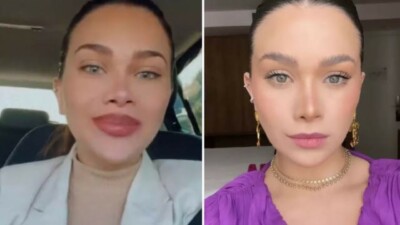 "Muitas coisas na minha vida melhoraram", Flávia Pavanelli diz que "perdeu a mão" com procedimentos no rosto e web concorda: "Distorcida"