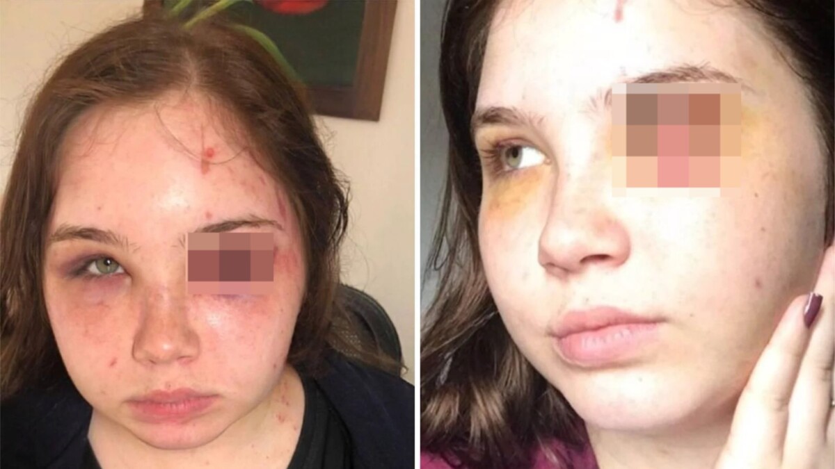 Jovem disse que é agredida pelo pai desde criança Cantor sertanejo é acusado de agredir e ameaçar a própria filha de morte