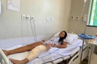 Wanderlyne Gomes quebrou o joelho e ficou internada 8 dias Mulher ferida em acidente no viaduto da T-63 que matou dois jovens recebe alta