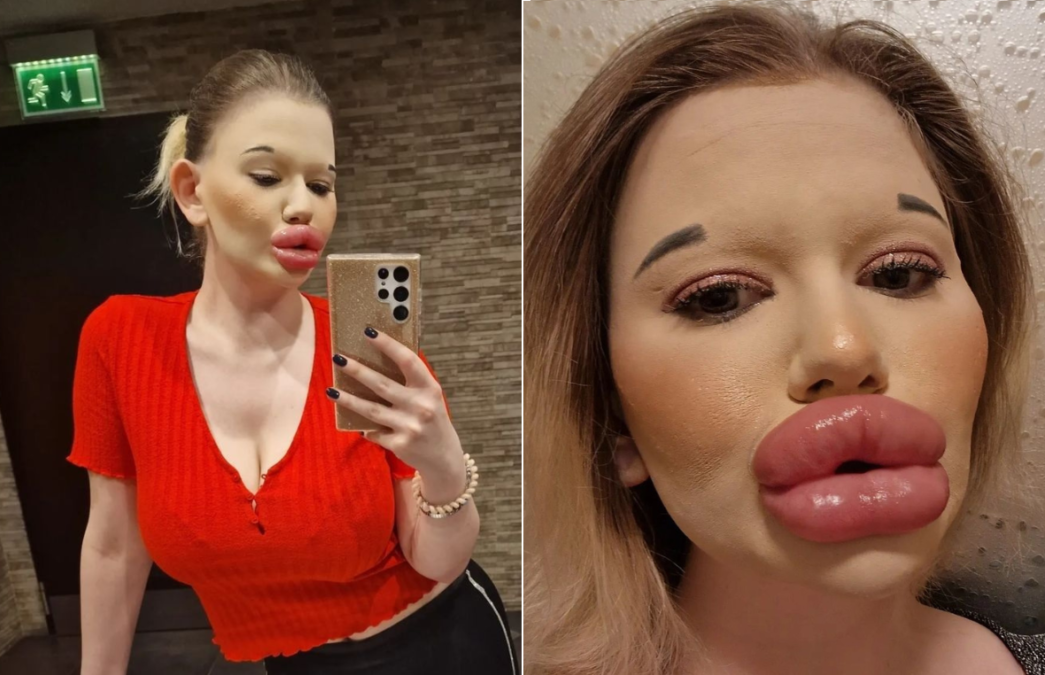 Dona dos 'maiores lábios do mundo' diz ter dificuldade para encontrar namorado Andrea Ivanova diz que há homens que a acham 'estranha e louca'