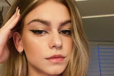 Jovem de 18 anos morre em SC após infecção por bactéria via acne Bactéria Staphylococcus aureus provocou infecção generalizada