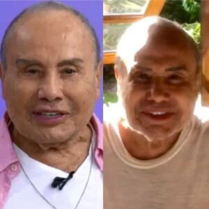 Antes e depois de Stênio Garcia, após harmonização facial (Foto: redes sociais)