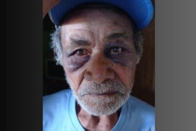 Idoso de 81 anos agredido em Catalão morre após 14 dias na UTI