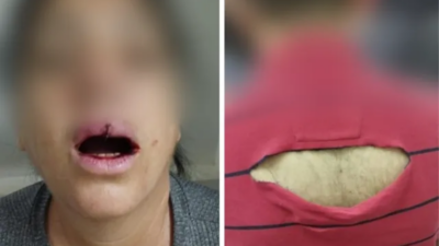 Avós brigam com médico após perguntas à neta durante consulta, em São Luís de Montes Belos