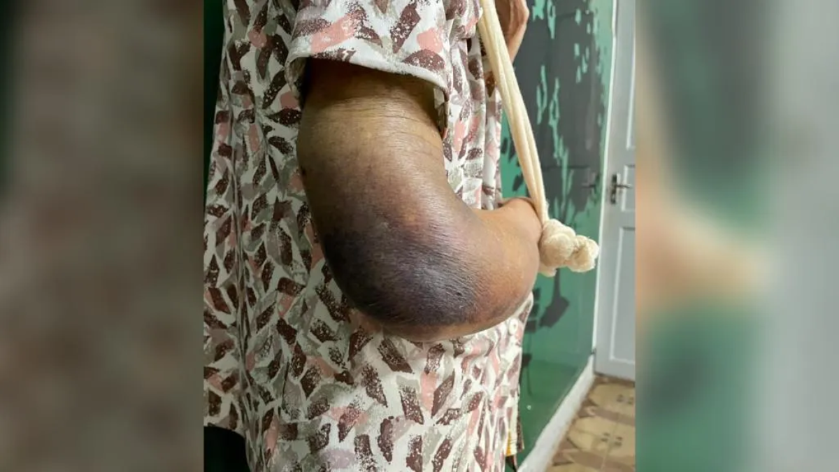 Idosa é resgatada com braço quebrado após filha enfermeira negar ajuda, em Goiânia