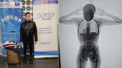 presa com cocaína na vagina Jovem é presa em aeroporto da Argentina com 11 cápsulas de cocaína na vagina e outras 67 no estômago droga de Buenos Aires a Barcelona