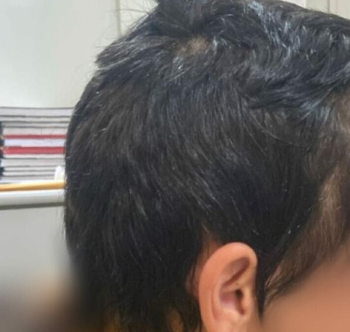 Mulher tem o cabelo cortado pelo companheiro em Abadia