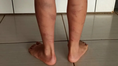 Criança de 8 anos é espancada pelo pai por assistir pornografia em Pirenópolis