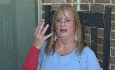 Mulher sobrevive a ataque de cobra e falcão ao mesmo tempo nos EUA Peggy Jones, de 64 anos, teve diversos ferimentos no braço e no rosto