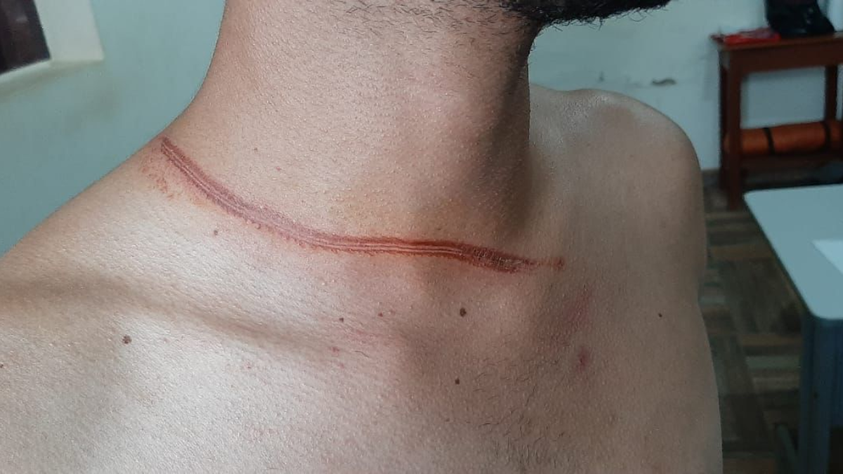 Homem é preso após usar fio atravessado em rua para provocar acidentes em Porangatu