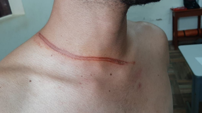 Homem é preso após usar fio atravessado em rua para provocar acidentes em Porangatu