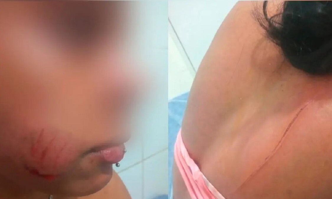 Mulher agredida em Caldas Novas