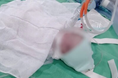 Prefeitura de Luziânia diz que servidor que liberou corpo de bebê à família errada foi afastado