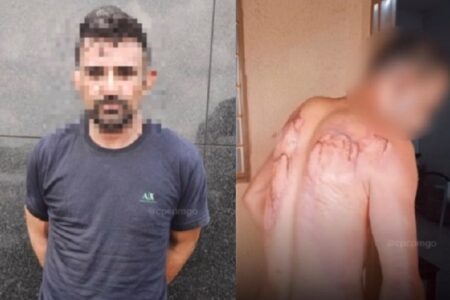 Homem é preso após atear fogo no corpo de vizinho em Goiânia Vítima recebeu atendimento médico e segue internada
