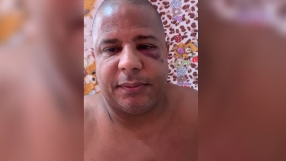 Com sinais de agressão, Marcelinho Carioca diz em vídeo que foi sequestrado