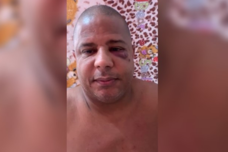 Com sinais de agressão, Marcelinho Carioca diz em vídeo que foi sequestrado